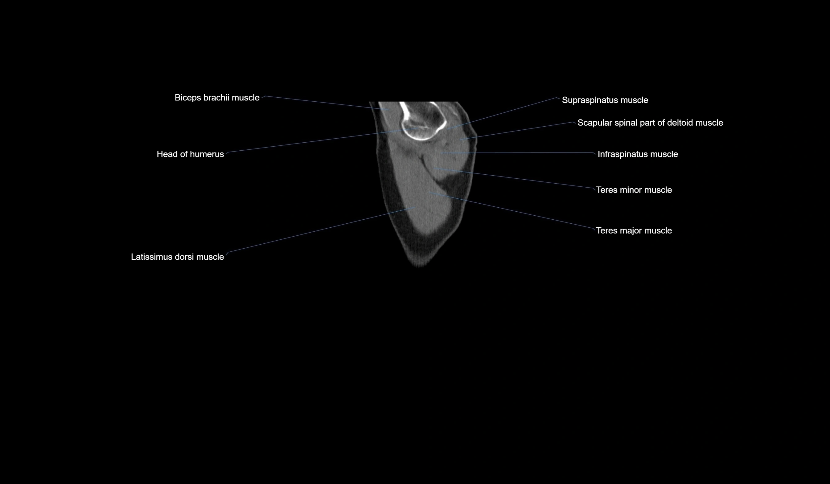 CT chest (thorax) labelled sagittal cross sectional anatomy radiology image-00001.webp